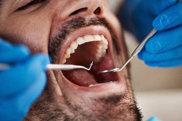  Barrett, TX Emergency Dentist Pros