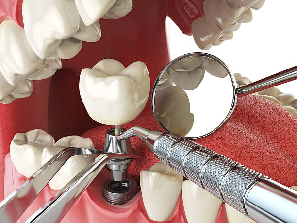 Best Emergency Root Canal Therapy in Barrett, TX