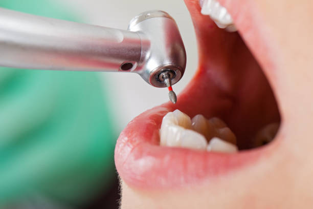 Best After-Hours Dental Care in Barrett, TX